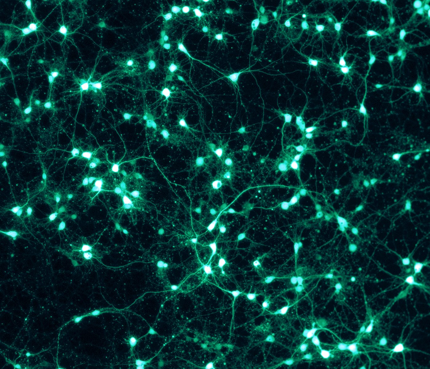 Neurons expressing green fluorescent protein